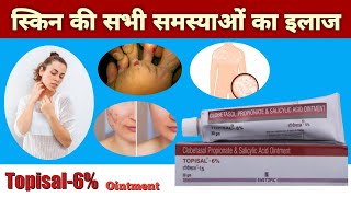 Topisal 6 Persent Ointment For Acne Pimples Psoriasis Skin Infection Eczema Contact Dermatitis [upl. by Nywled]