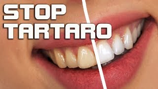 Togliere il tartaro dai denti rimedi naturali per la pulizia dei denti [upl. by Tabber]