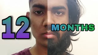 1 YEAR Hair and Beard Growth Time Lapse [upl. by Gary]