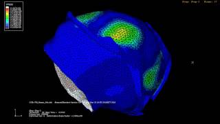 conflito femuroacetabular [upl. by Soble393]