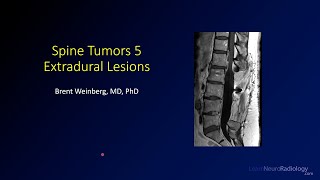 Spine tumors 5 – Extradural Lesions [upl. by Aoniak406]