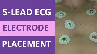 5 Lead ECG Placement of Electrodes EKG NCLEX amp Nursing Mnemonic [upl. by Ammadas]