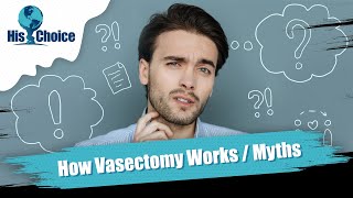 His Choice Vasectomy  How does a vasectomy procedure work [upl. by Innes327]