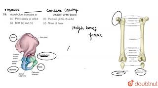 Acetabulum is present in [upl. by Akimot813]