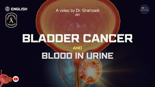 Bladder Cancer Early Signs Symptoms and Blood in Urine Explained [upl. by Bultman]