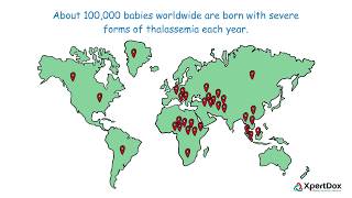 What is Thalassemia [upl. by Eeluj]