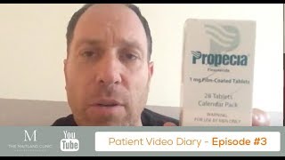 FUT Hair Transplant Results Side Effects of Propecia  Patient Review Diary 3 [upl. by Eico]