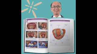 Prótesis completa mandibular con técnica de succión Jiro Abe [upl. by Atinihs]