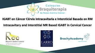 Image Guided Adaptive Intracavitary and Interstitial Brachytherapy for Cervical Cancer [upl. by Akieluz]