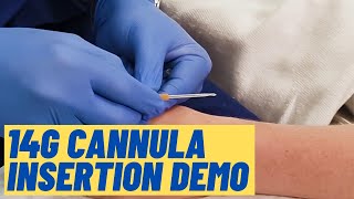 Large 14G cannula insertion technique  Live Demo [upl. by Breed]