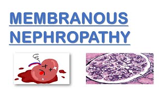 Membranous Nephropathy  Nephrotic Syndrome  Made Easy [upl. by Payson]