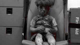 Haunting Visual Of Injured OmranDaqneesh Rescued After Air Strike In Syria [upl. by Hornstein]