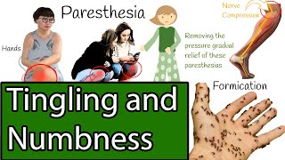 Numbness and Tingling Causes of Paresthesia [upl. by Yeliw437]