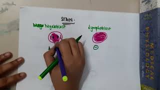 myeloblast vs lymphoblast  Hematology [upl. by Ahsiekar]