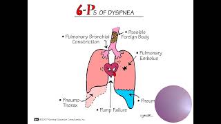 Pathophysiology and Management [upl. by Bakki]