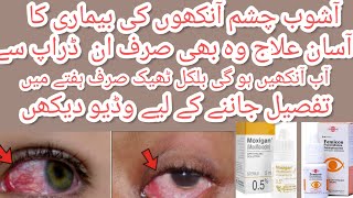 Moxigan amp femicon eye drops uses in urdu l best for eyes infection and itching by aneespharmacist [upl. by Viking]