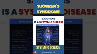 Sjogrens a Systemic Disease  signs and symptoms sjogren sjogrens autoimmunedisease [upl. by Barrington47]