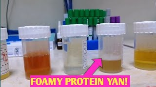 ETO PATUNAY PAG FOAMY ANG IHI MAY PROTEIN YAN [upl. by Oringas19]