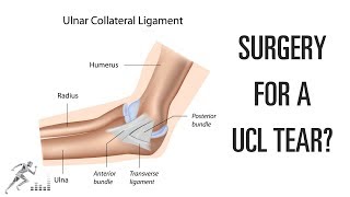 Do you need surgery for a UCL tear [upl. by Onabru199]