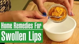 How To Get Rid Of A SWOLLEN LIPS Fast With Home Remedies [upl. by Itin]