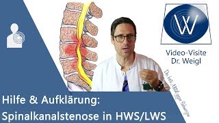 Spinalkanalstenose Rückenschmerzen durch Spinalstenose in HWS LWS ⚡ Symptome Gefahren amp Therapie [upl. by Ocsisnarf]