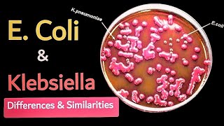 Difference between E coli and Klebsiella 🧫 lactose fermentor enterobacteriaece 🔬 [upl. by Litsyrk110]