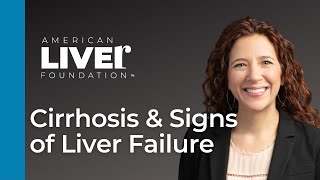 Progression of Liver Disease Webcast Series Cirrhosis and Signs of Liver Failure [upl. by Lenz]