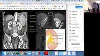 Renal and collecting system Radiology USMLE Content List [upl. by Allmon]