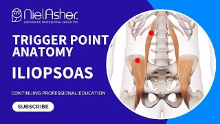 Exploring the Iliopsoas Understanding Trigger Point Locations for Better Muscle Health [upl. by Ollecram297]