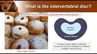 Types of Intervertebral disc disease  from the expert [upl. by Atillertse]