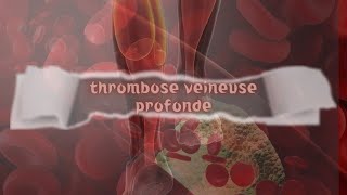 La thrombose veineuse profonde [upl. by Obbard]