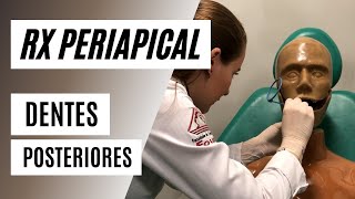 Como radiografar dentes posteriores com posicionador  Técnica periapical [upl. by Adnofal946]