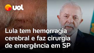 Lula tem hemorragia cerebral e faz cirurgia de emergência em São Paulo após acidente no banheiro [upl. by Naujyt]