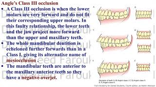 Dental 11 Mastication Part 1 [upl. by Katharina]