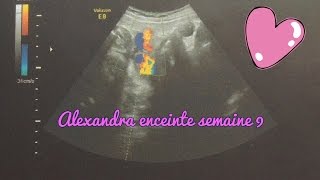 Alexandra enceinte  semaine 9 [upl. by Rowney]