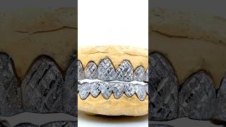 Check Out These BlingedOut White Gold Grillz 💎 [upl. by Tearle678]