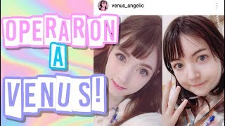 De qué operaron a VENUS ANGELIC  Investigamos su INSTAGRAM ❤ Anita [upl. by Marston]