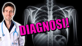 3 segnali di TUMORE i sintomi da conoscere per fare diagnosi [upl. by Suivatna412]