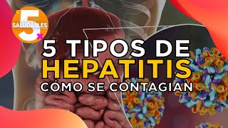 ¿Cómo se contagia la hepatitis   Salud 180 [upl. by Sedgewinn]