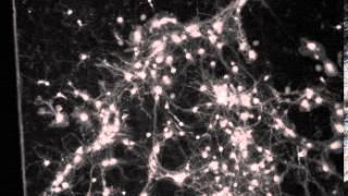 Calcium imaging in neuronal culture [upl. by Pros]