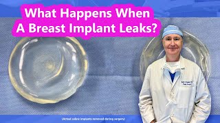 What Happens When a Breast Implant Leaks [upl. by Aineval853]