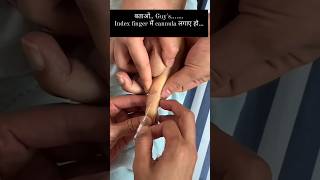 Index finger canulation hospital education [upl. by Mccartan]