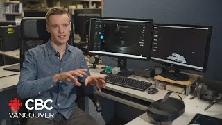 Remote ultrasound technology a potential diagnostic gamechanger [upl. by Anoiek347]