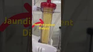 Jondice patient का डायलिसिस होने के बाद कैसे हो जाती है dialyzer dialysis kaise hota haidialysis [upl. by Nerahs]