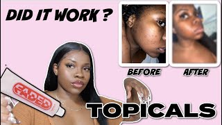 I Tried Topicals Faded For 6 Weeks On My Dark Skin For My Hyperpigmentation Scars [upl. by Nhor862]