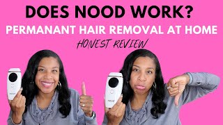 Does NOOD Work for Permanent Hair Removal  Nood Review  Real Review of Nood AtHome Hair Remover [upl. by Keener]