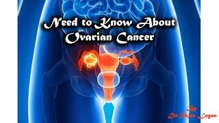 Ovarian Cancer  Nalanthaana Epi 61  DrRajesh Logan [upl. by Evilo812]