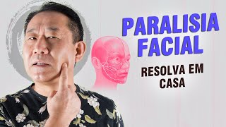 PARALISIA FACIAL MÉTODO CASEIRO QUE RESOLVE  Dr Peter Liu [upl. by Dazhehs]