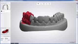 3Shape Dental System  Scanning for Full Anatomical Crown [upl. by Libbey]