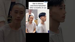 The change in his hair makes him look great right viral hisako haircare feedback [upl. by Noraj467]